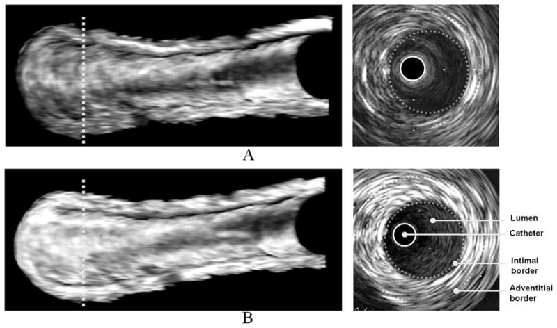 FIGURE 3