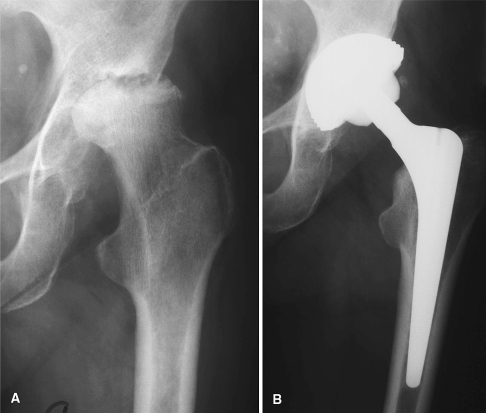 Fig. 3A–B