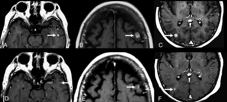 Fig 2.