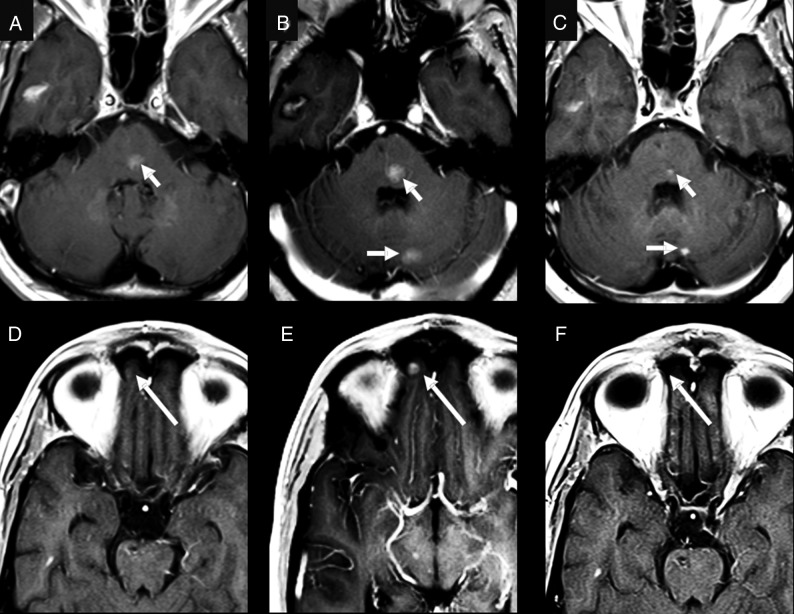 Fig 3.