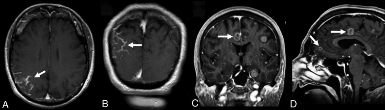 Fig 6.