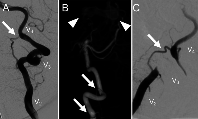 FIG. 1.