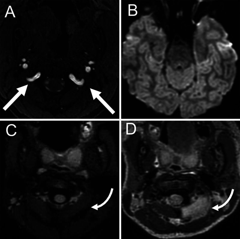 FIG. 2.