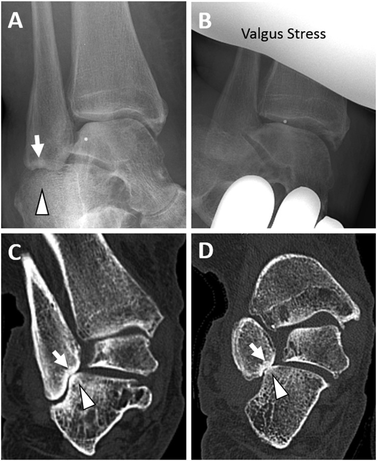 Figure 16.