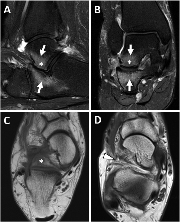 Figure 17.