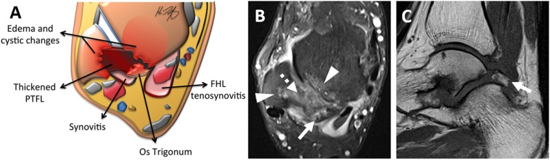 Figure 13.