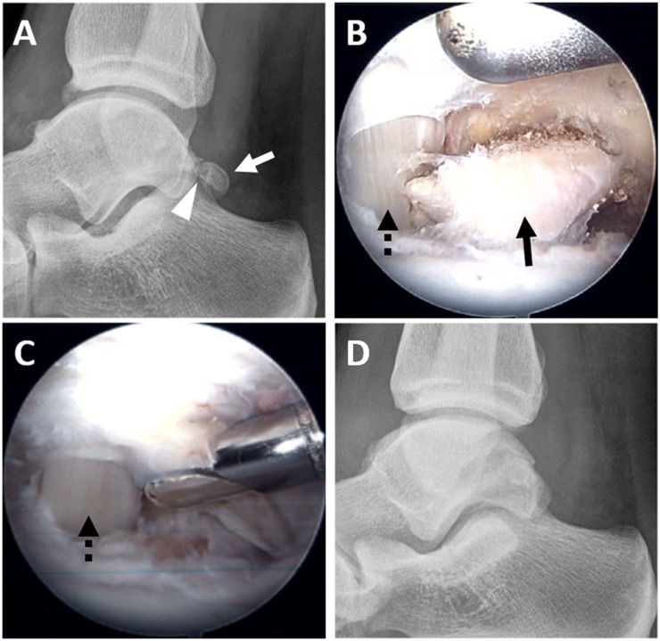 Figure 15.