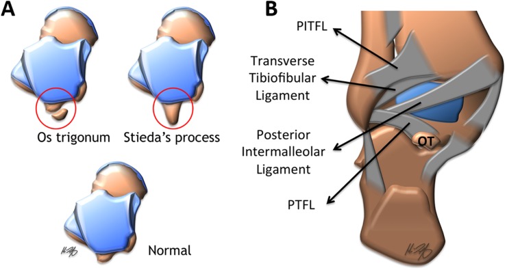 Figure 11.