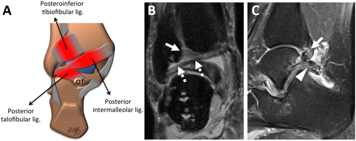 Figure 14.