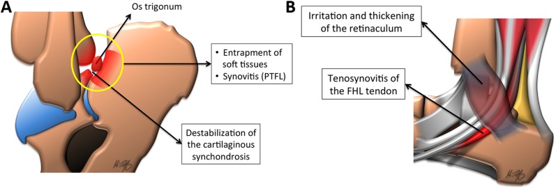 Figure 12.