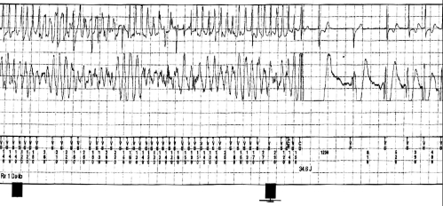 Figure 5)