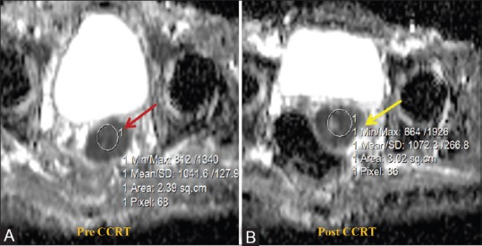 Figure 10 (A and B)