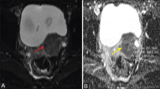 Figure 4 (A and B)