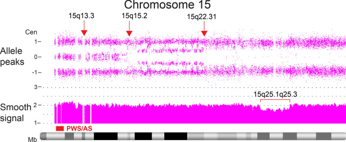 Fig. 12