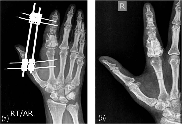 Fig. 8b