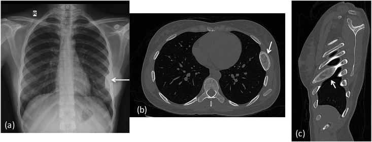 Fig. 11