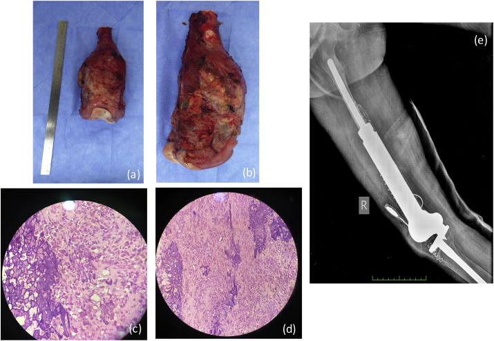 Fig. 4b