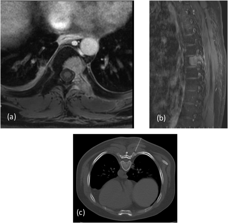 Fig. 6b