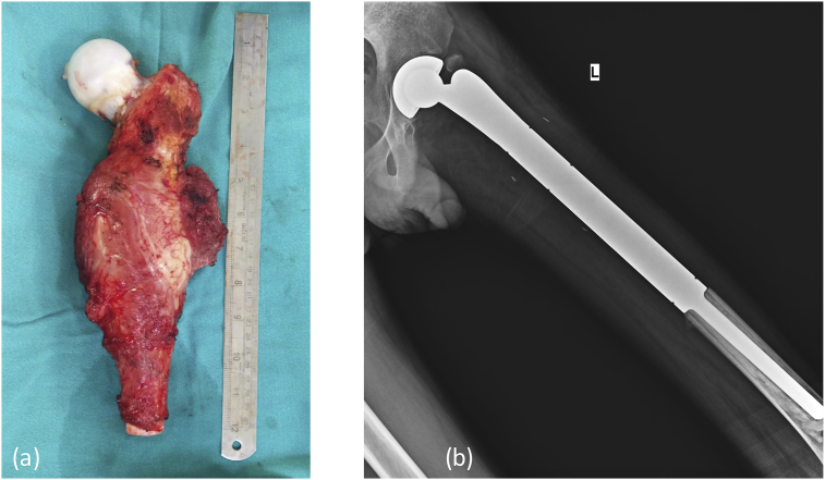 Fig. 2b