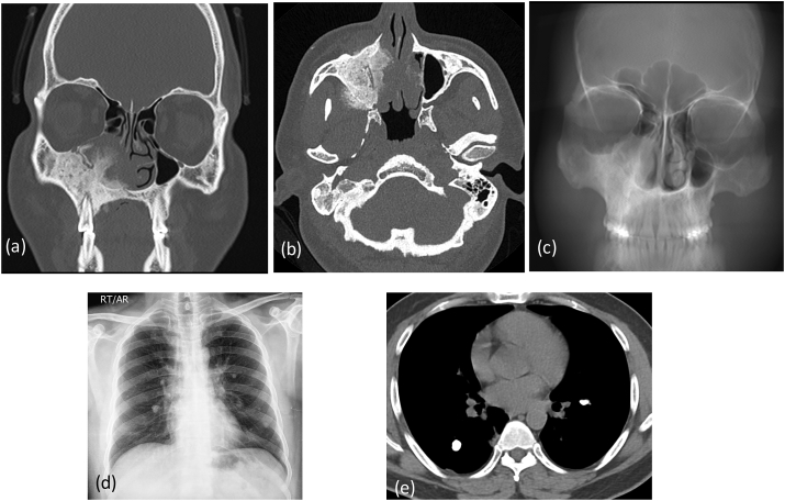 Fig. 6a