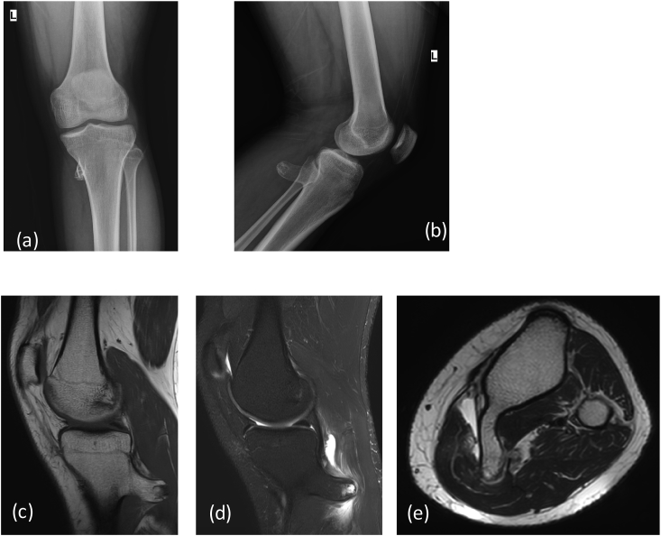 Fig. 12