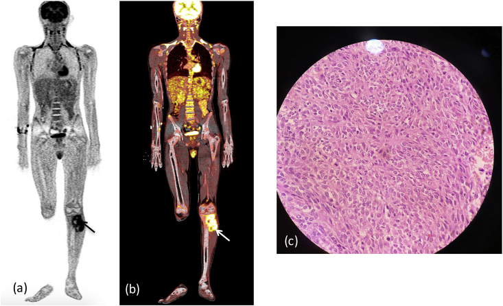 Fig. 1b