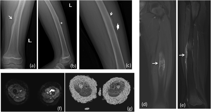 Fig. 3a