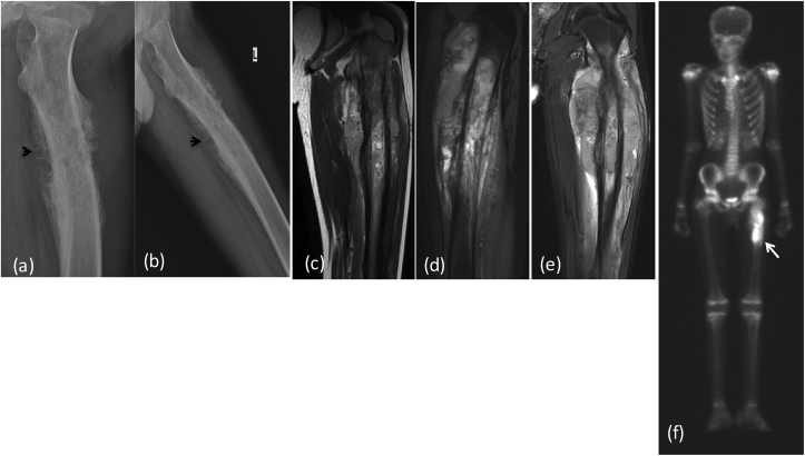 Fig. 2a