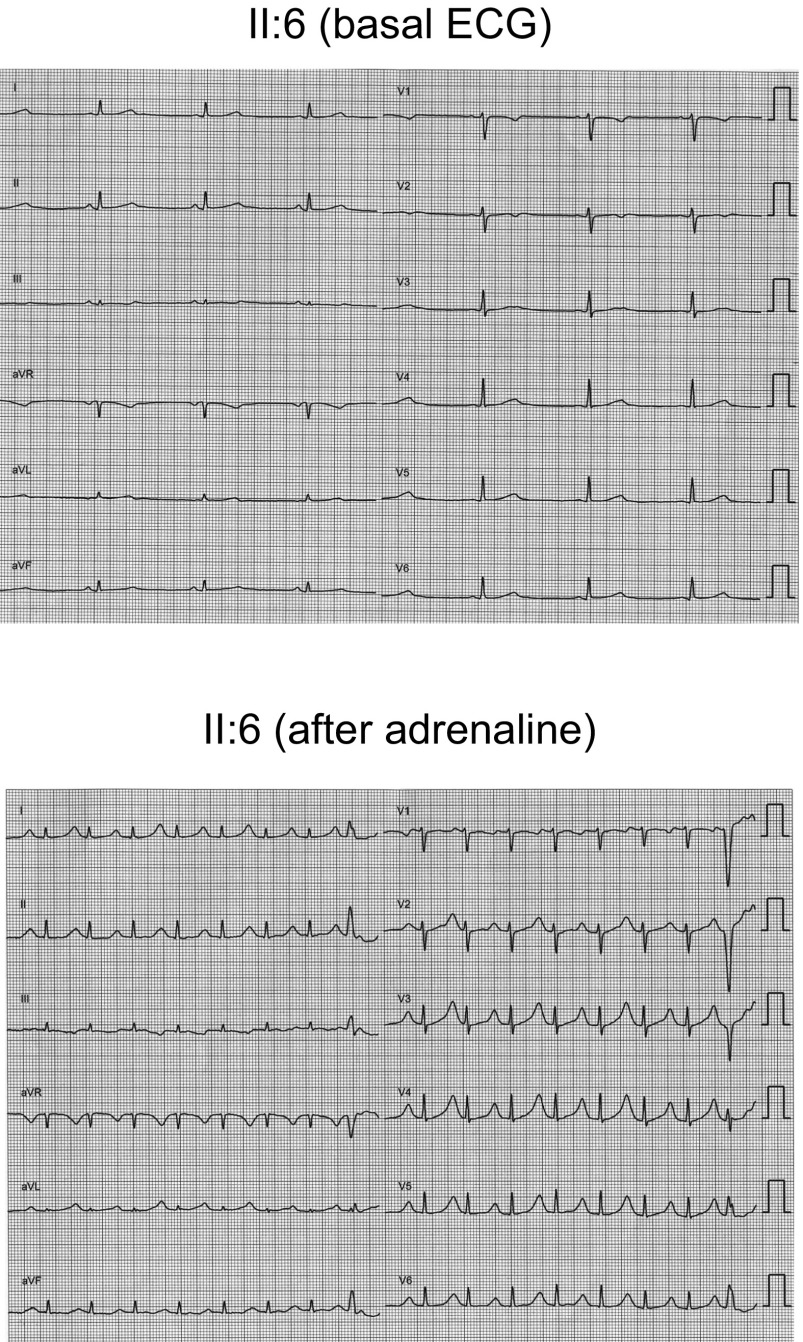 Fig. S1.