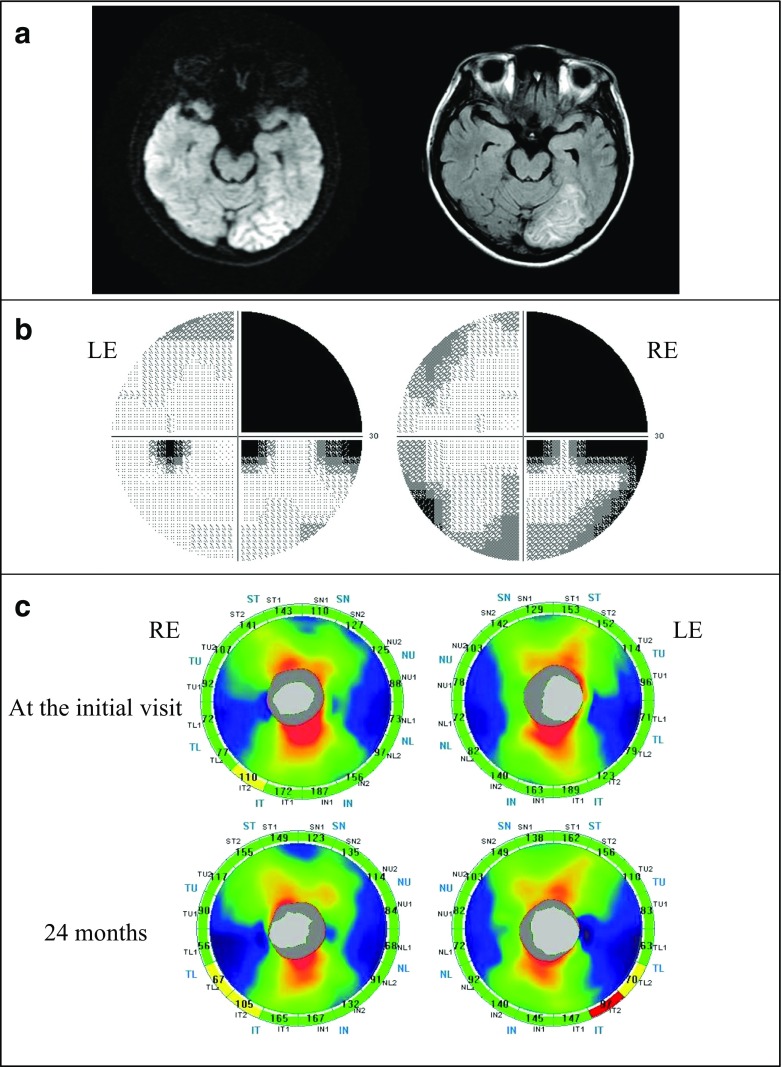 Fig. 4