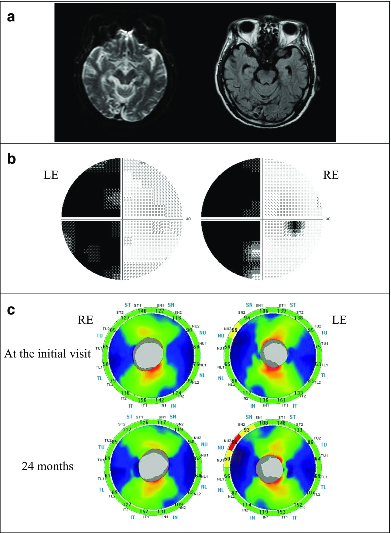 Fig. 5