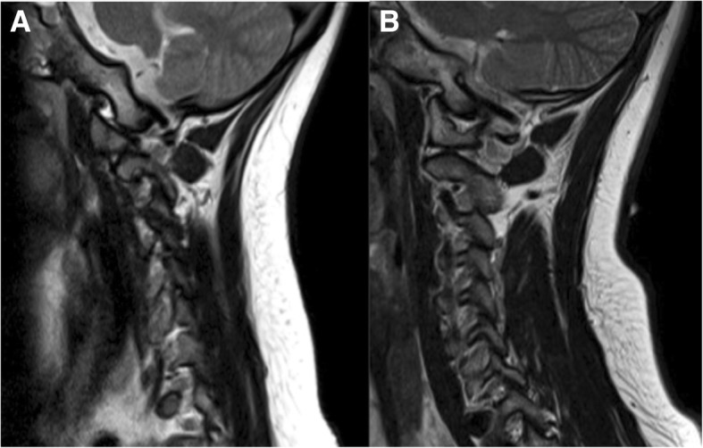 Fig. 13