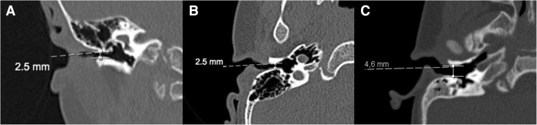 Fig. 5