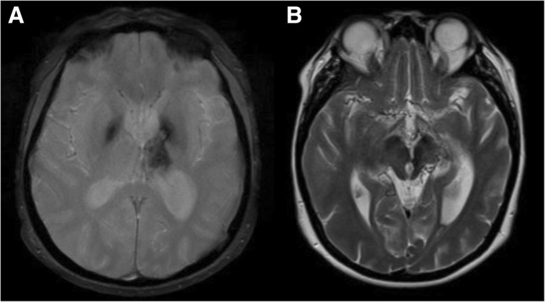 Fig. 16