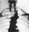 256