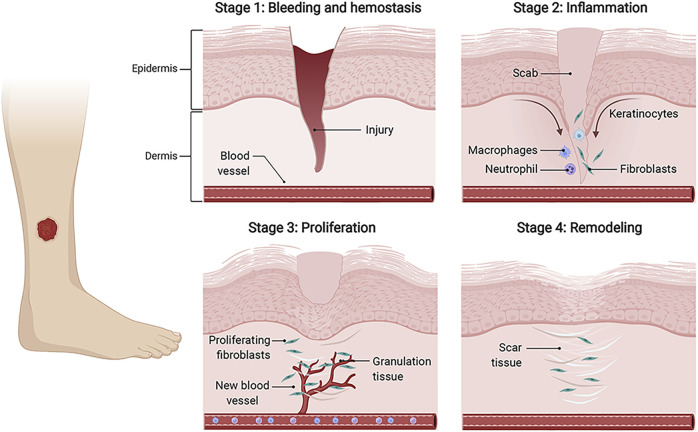 FIGURE 1