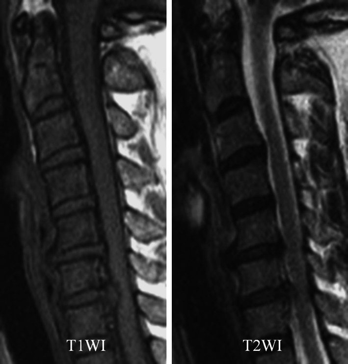 Fig. 1