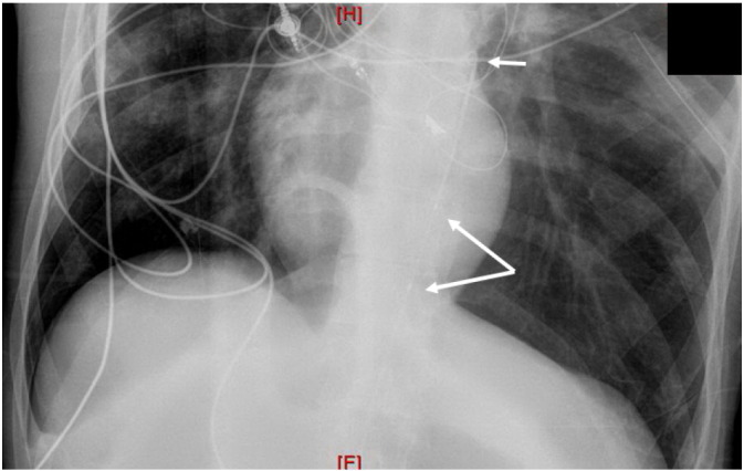 Fig. 3