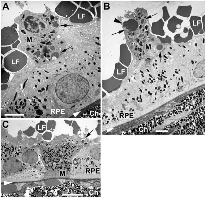 Figure 11.