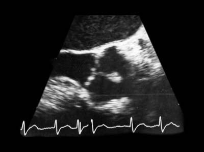 graphic file with name 24FF1.jpg