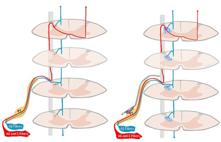 Figure 13