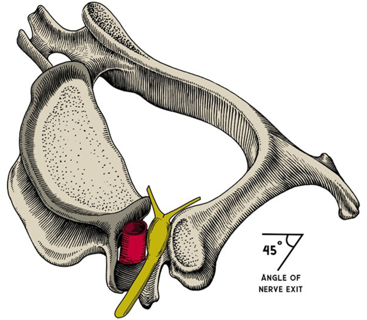 Figure 12