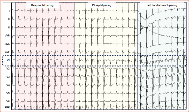 Figure 2: