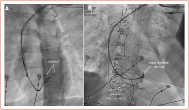 Figure 3: