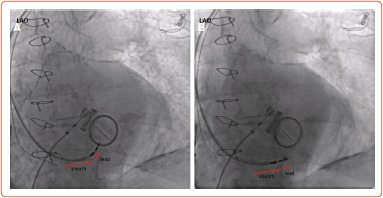 Figure 4: