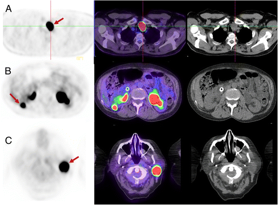 Fig. 10