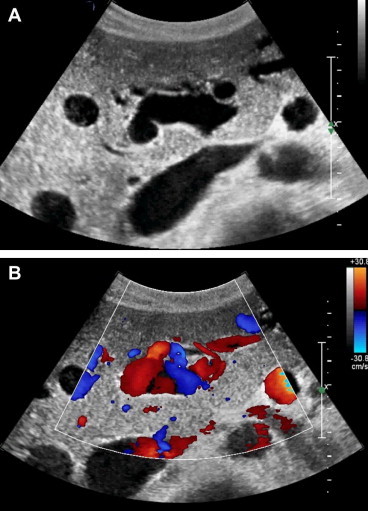 Figure 4