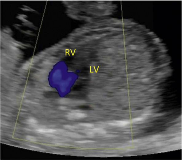 Fig. 4