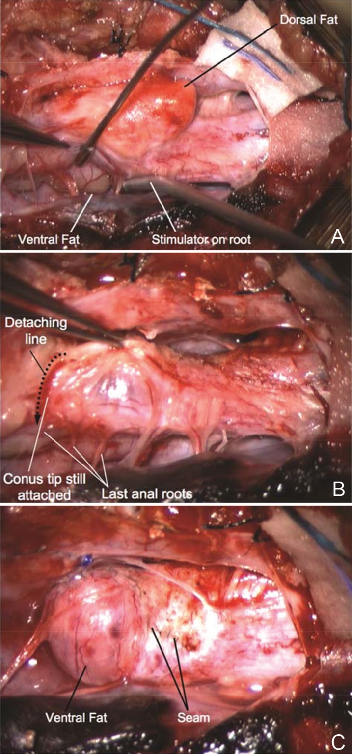 Fig. 32