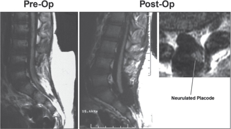 Fig. 43